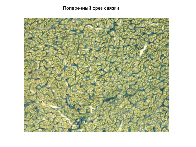 Поперечный срез связки